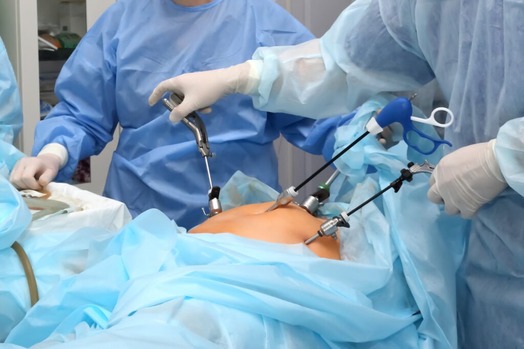 Laparoscopic surgery